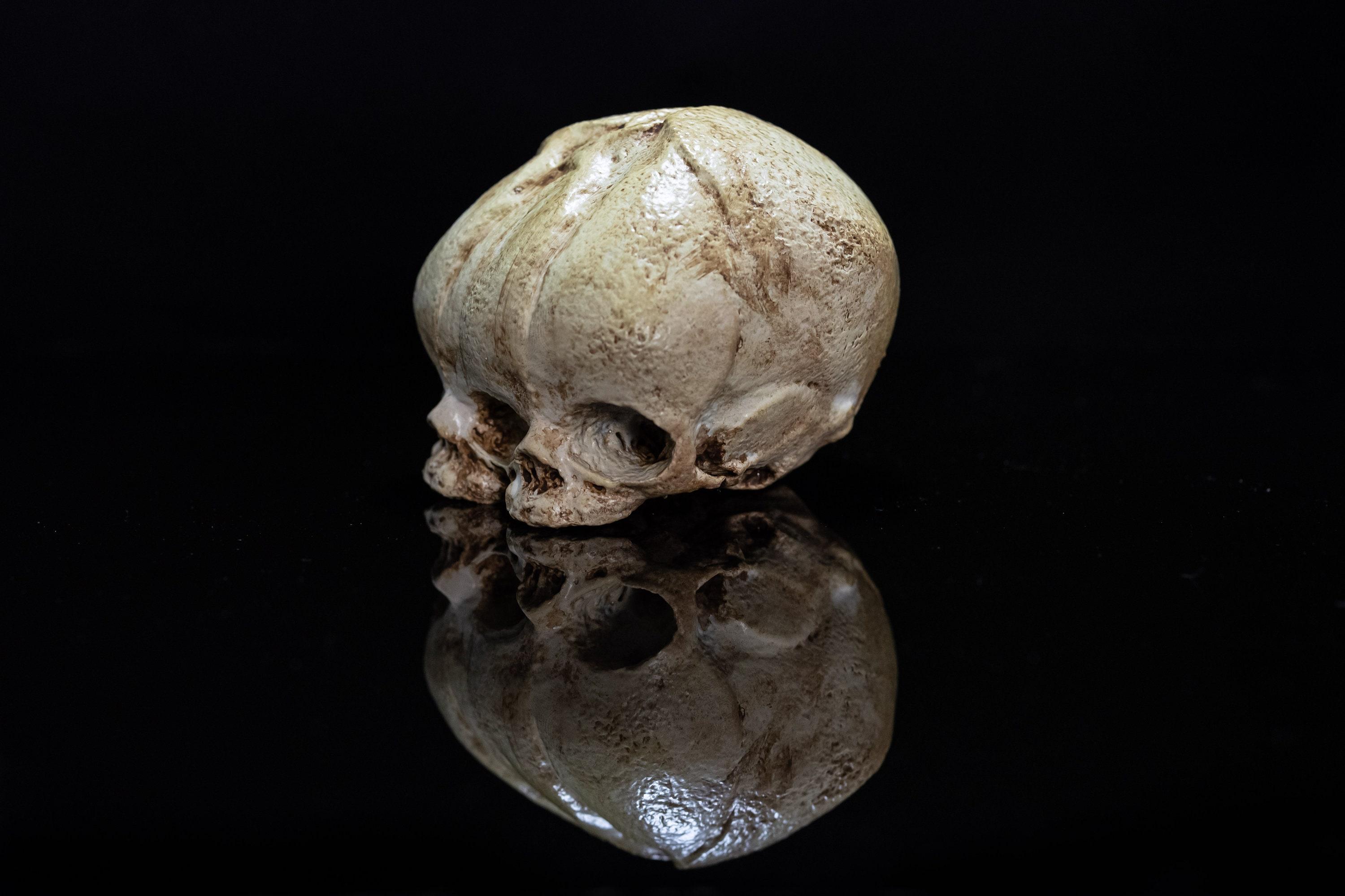 Conjoined Fetal Skull 3d model