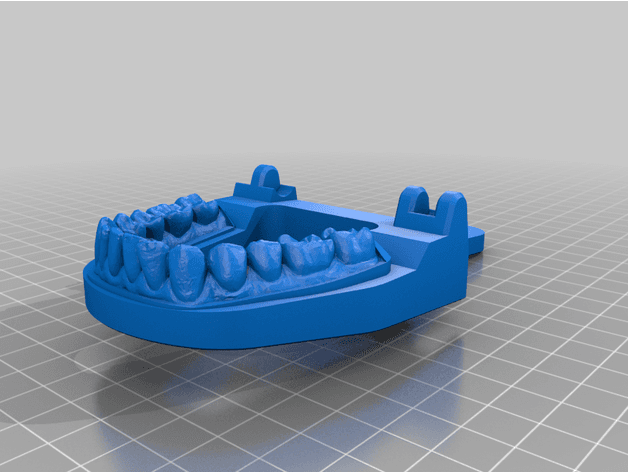 Mouth Chip Clip from 3D Scan of Teeth 3d model