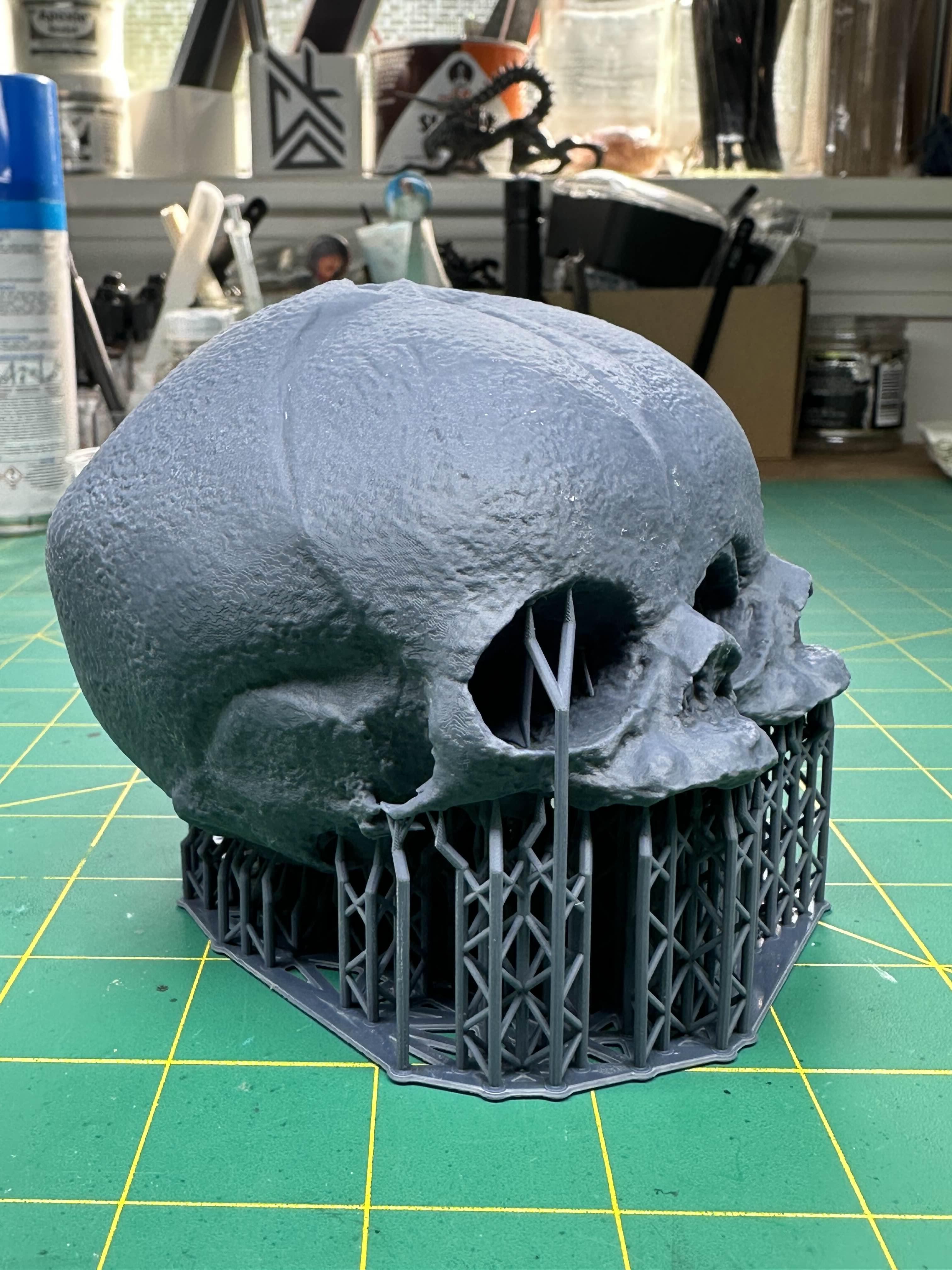 Conjoined Fetal Skull 3d model