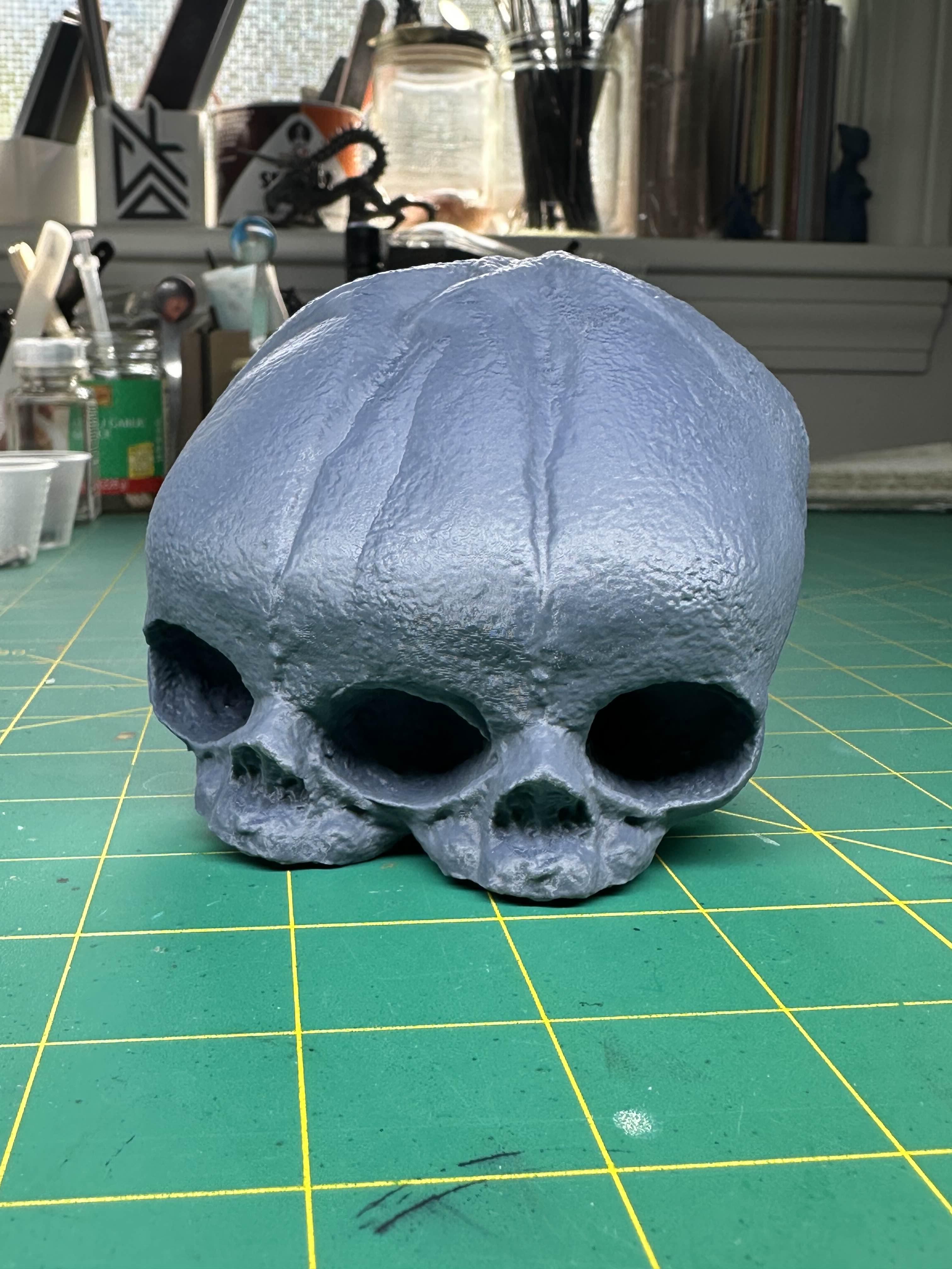 Conjoined Fetal Skull 3d model