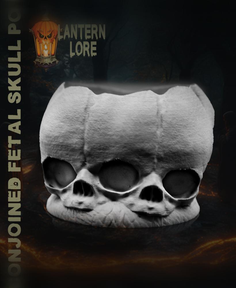 Conjoined Fetal Skull Pot (Pre Supported) 3d model