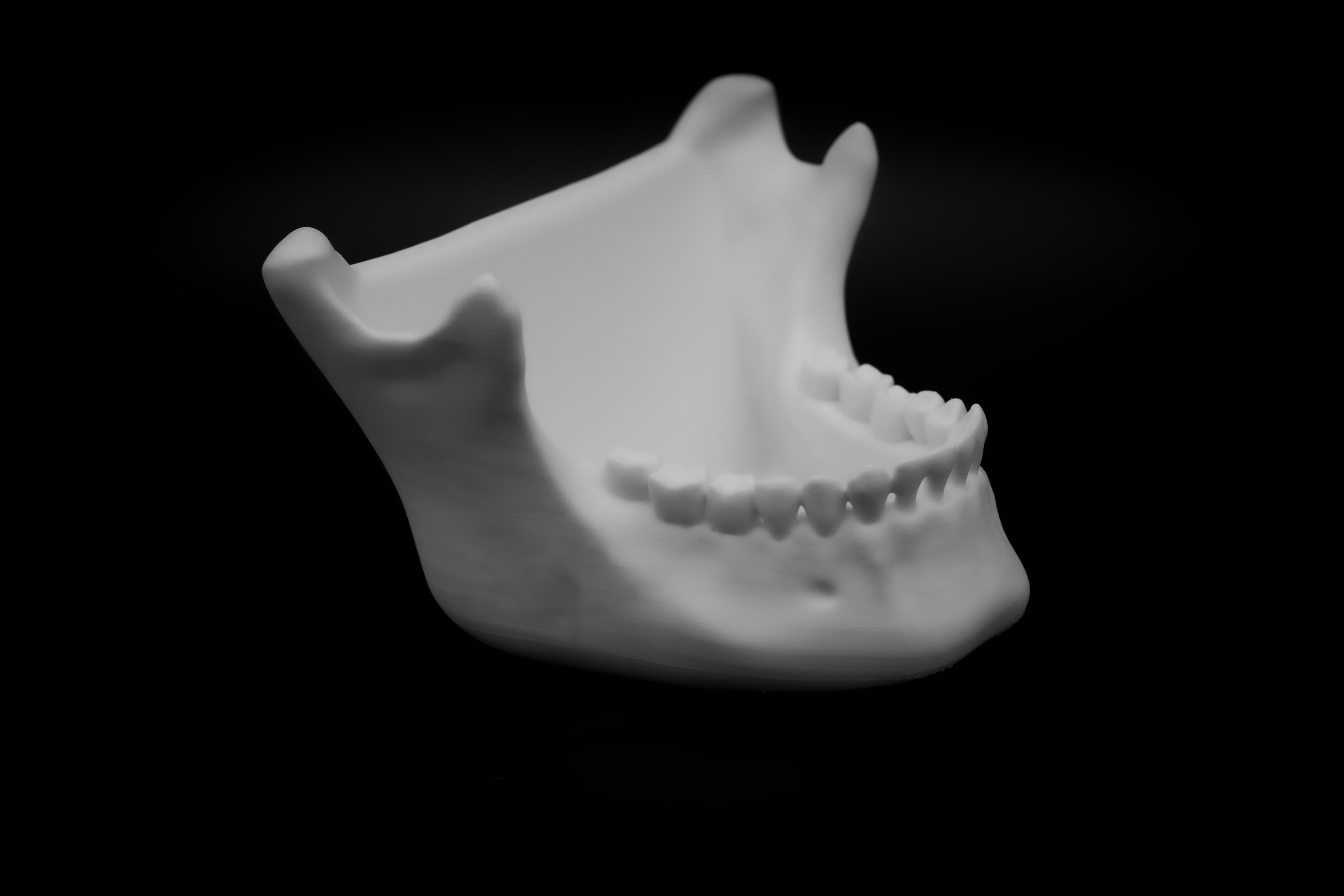 Human Jaw Bone Bowl (Pre Supported) *New Release*