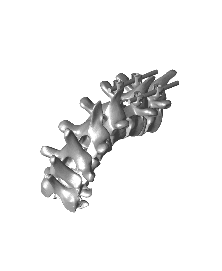 PJK cervicothoracic junction bennett render  3d model