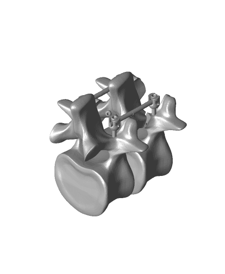 pedicle pars construct.stl 3d model