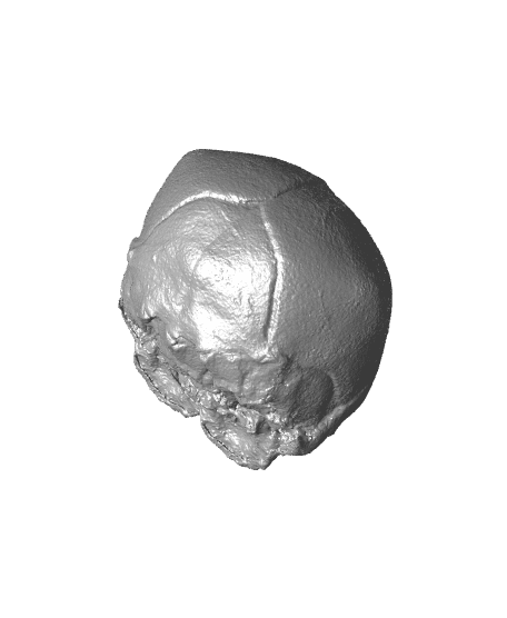 Conjoined Fetal Skull 3d model