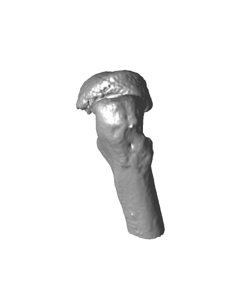 Perthes Hips 3d model