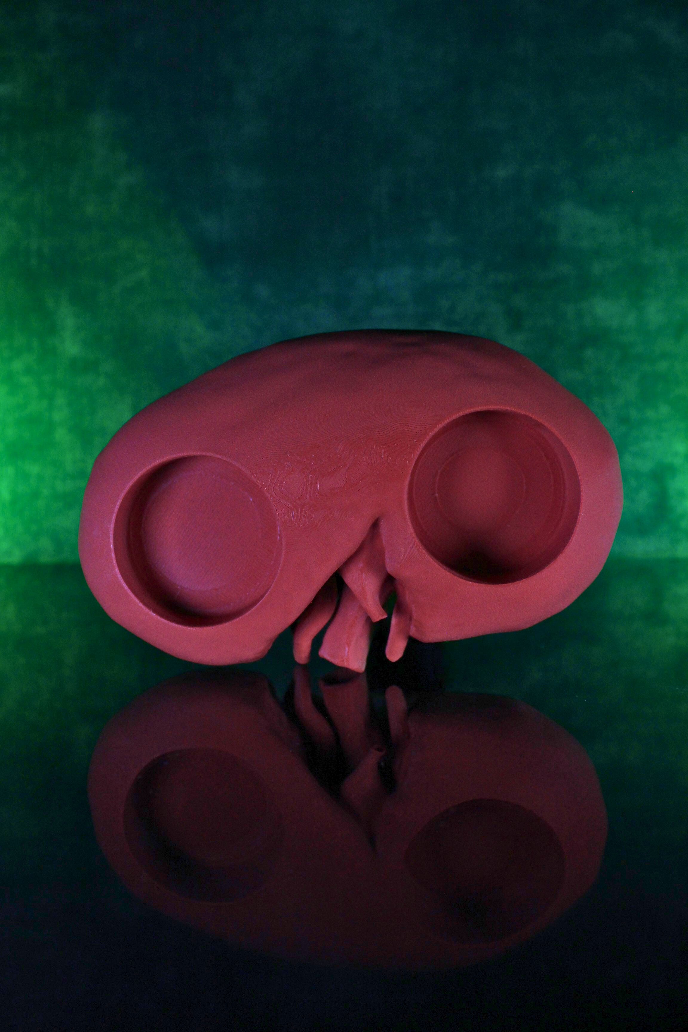 Full Kidney Tea Light (Pre Supported) 3d model