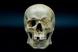 One-Eyed Willy Skull from Goonies 3d model