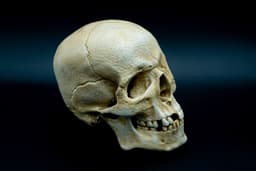 One-Eyed Willy Skull from Goonies 3d model