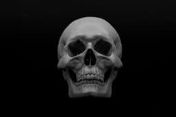 Human Skull (Pre Supported) 3d model