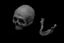 Human Skull (Pre Supported) 3d model