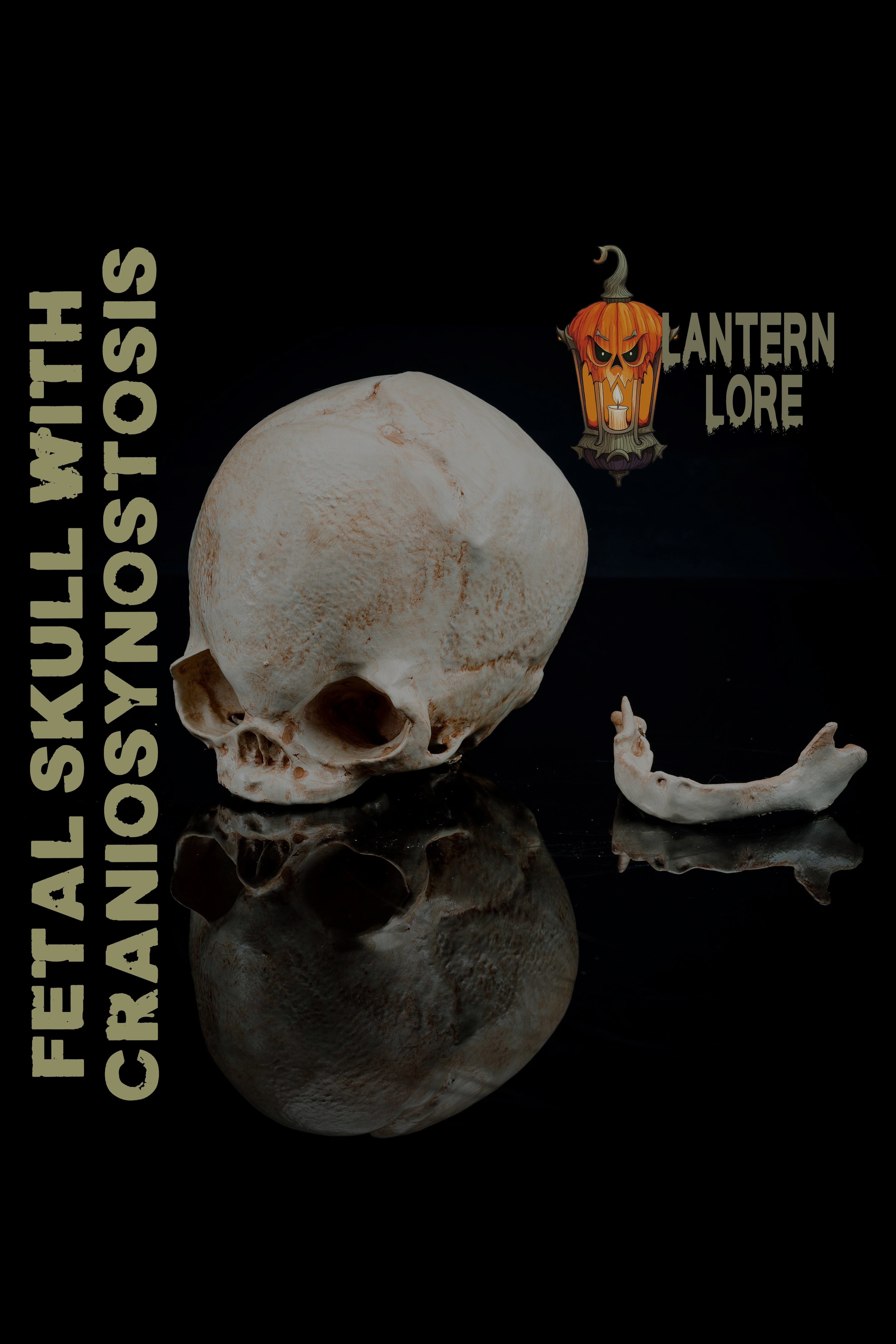 Fetal Skull with Craniosynostosis (Pre Supported) 3d model