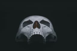 Human Skull Modular (Pre Supported) 3d model