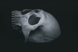 Human Skull Modular (Pre Supported) 3d model