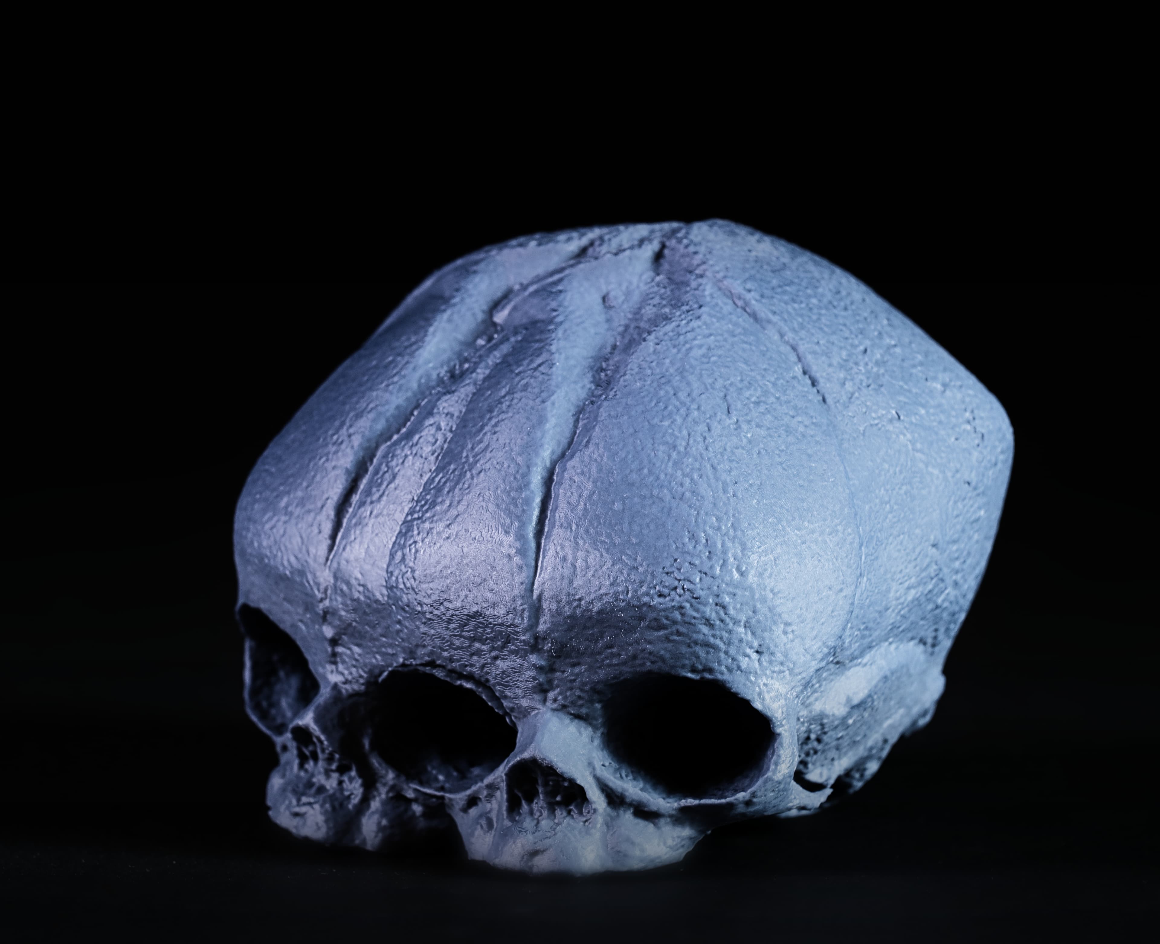Conjoined Fetal Skull 3d model